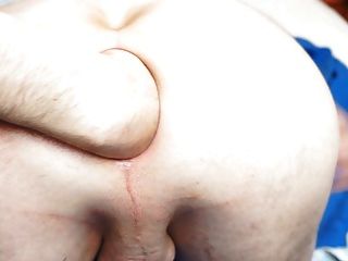 anal gape gaping asshole anal webcam porn tube video 1